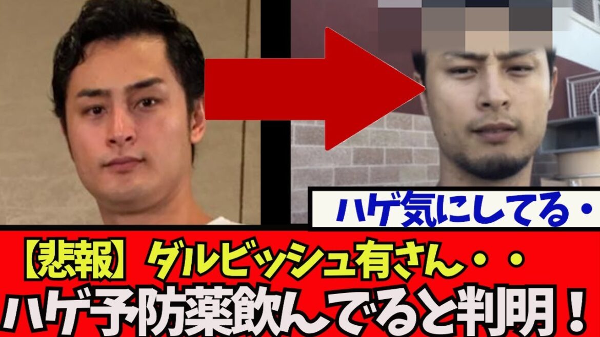 [Sad news]Mr. Darvish, it turns out that he was taking baldness preventive medicine because he was worried about his hair wwwww