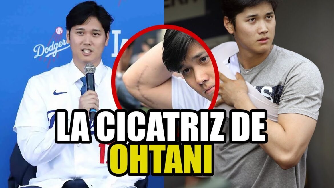 SHOHEI OHTANI’S SHOCKING SCAR AFTER THE TOMMY JOHN SHOHEI OHTANI'S SHOCKING SCAR AFTER THE TOMMY JOHN