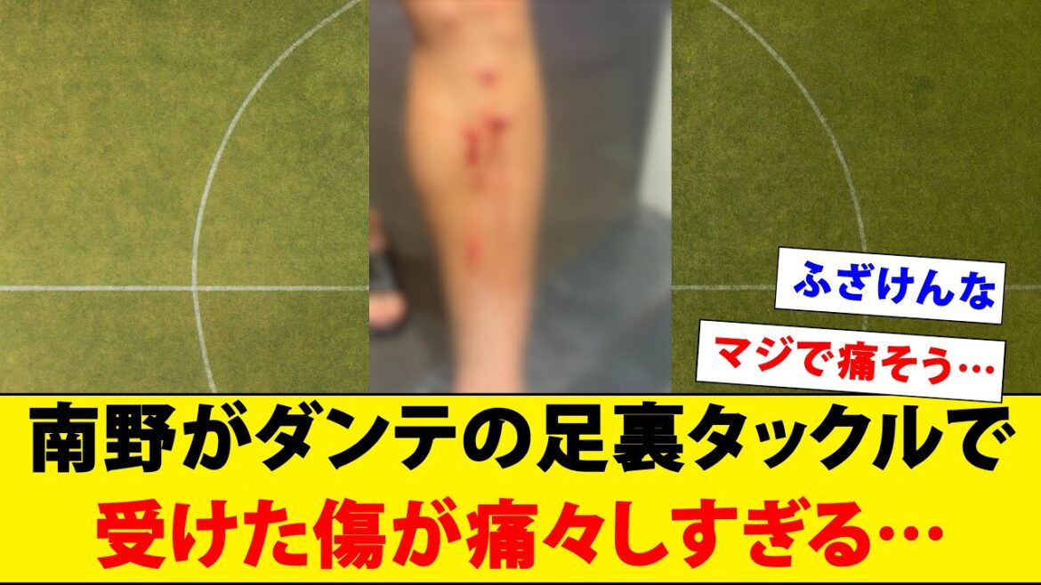 [Warning for minor viewing]The injury that Takumi Minamino received from Dante's sole tackle is too painful...