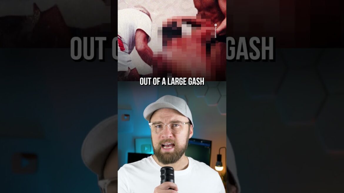 The Dive That Nearly Ended Greg Louganis The Dive That Nearly Ended Greg Louganis