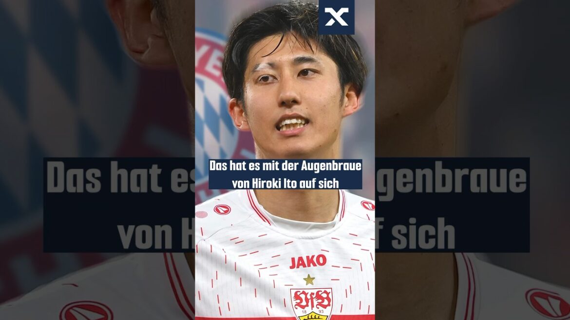 Dyed, shaved or injured? 🤨 #fcbayern #shorts Dyed, shaved or injured? 🤨 #fcbayern #shorts