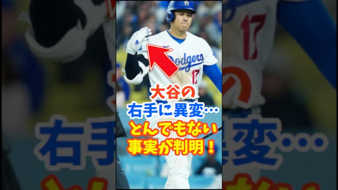 Shohei Otani's right hand turns out to be strange!