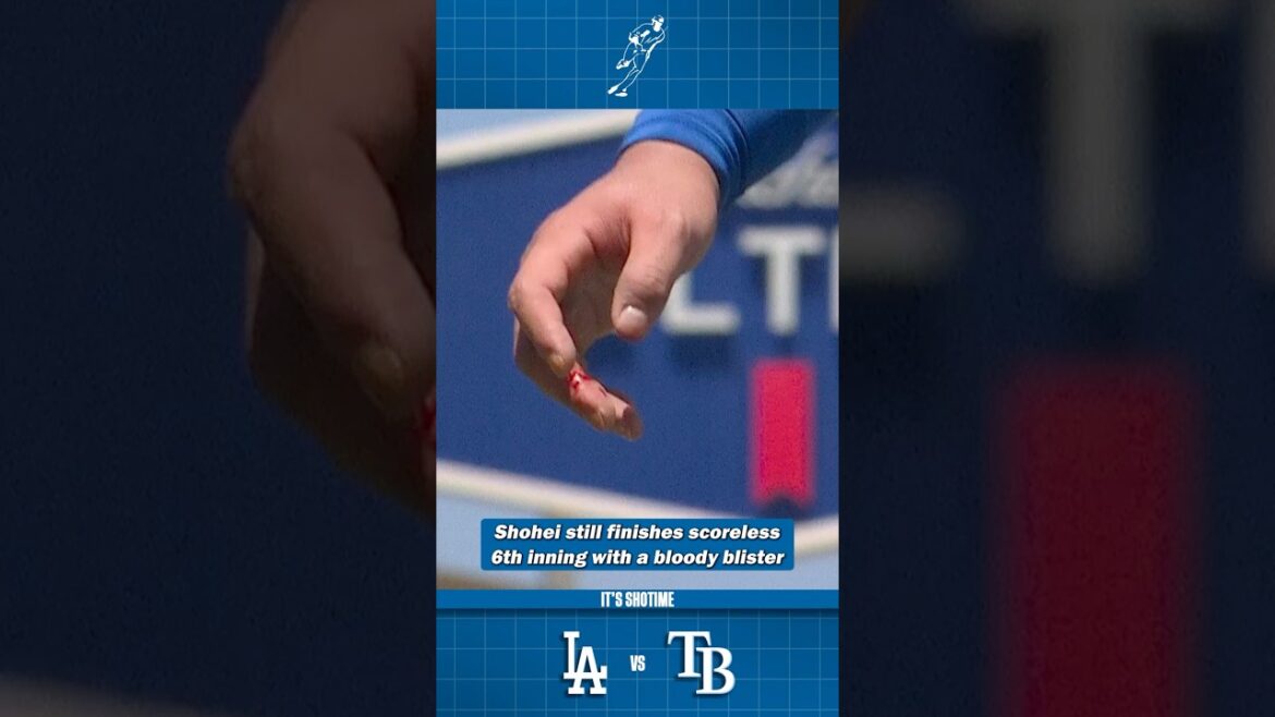 Shohei Throws Scoreless 6th With Bloody Blister