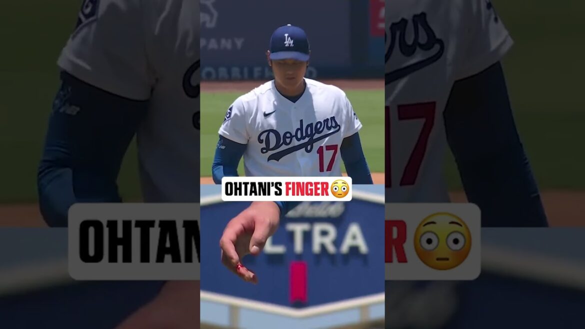 Shohei left the Dodgers' game against the Rays after allowing 4 ER in 6 IP 😳