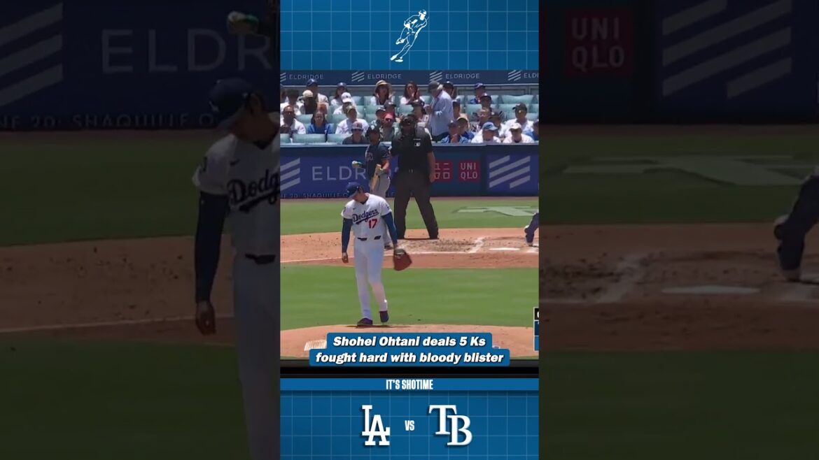 Shohei Fights Through Blister For 6 Innings