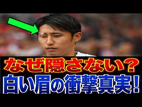 😱 The whole world cried… What is the real reason Hiroki Ito doesn’t hide his “white eyebrows”? 😱 The whole world cried... What is the real reason Hiroki Ito doesn't hide his "white eyebrows"?