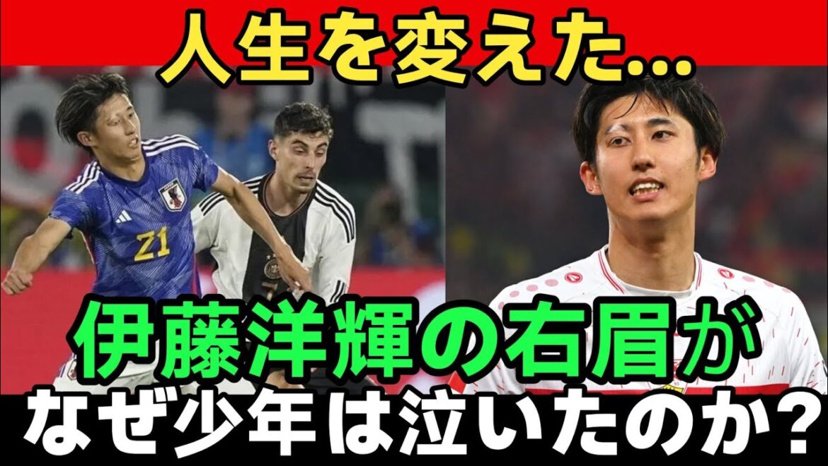 [Lacrimal gland collapse]"Just like me..." Hiroki Ito's right eyebrow, which does not hide his vitiligo, changed the life of one Brazilian boy... A miraculous story that brought tears to tears all over the world.