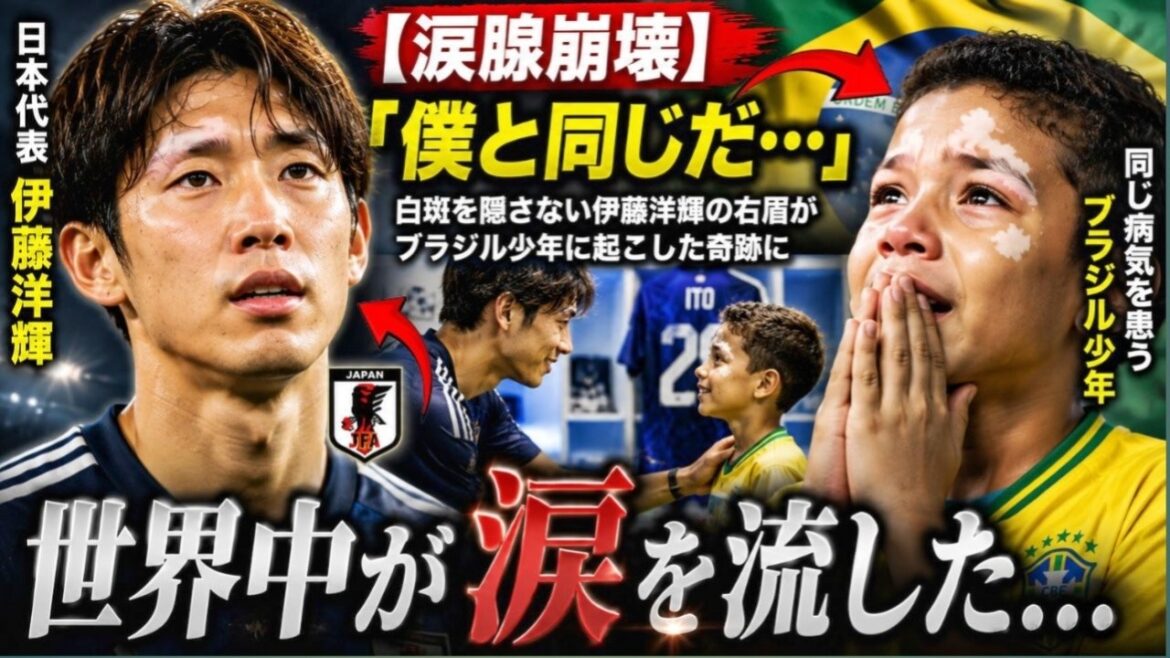 [Lacrimal gland collapse]"It's just like me..." The right eyebrow of Japanese representative Hiroki Ito, who doesn't hide his vitiligo, sheds tears all over the world at the miracle he created for a Brazilian boy suffering from the same disease... #HirokiItō