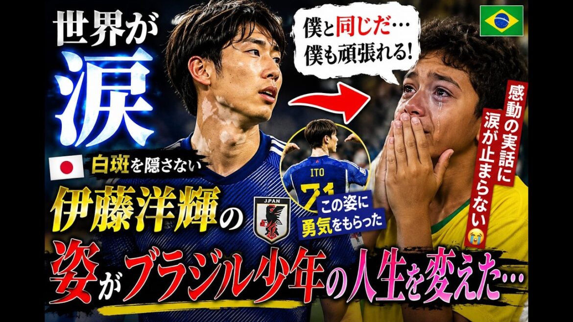 [The world is in tears]"Just like me..." Hiroki Ito's appearance of not hiding his vitiligo changed the life of a Brazilian boy... I can't stop crying from this moving true story 😭