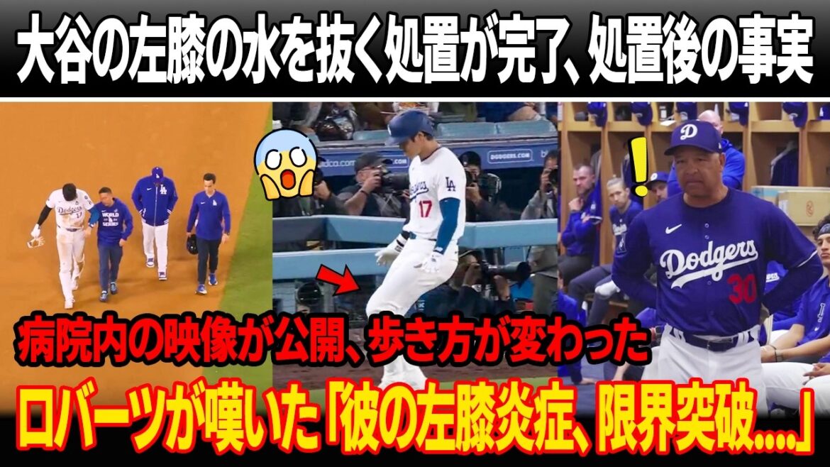 The procedure to drain water from Shohei Otani's left knee has been completed, and the facts revealed after the procedure! Video inside the hospital has been released, and the way he walks has changed... there is concern that it will spread to Otani! Coach Roberts lamented, ``He's already reached his limit.''