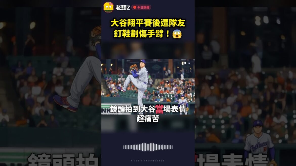 Shohei Ohtani was scratched on his arm by a teammate’s spike shoe after the game! 😱 Shohei Ohtani was scratched on his arm by a teammate’s spike shoe after the game! 😱